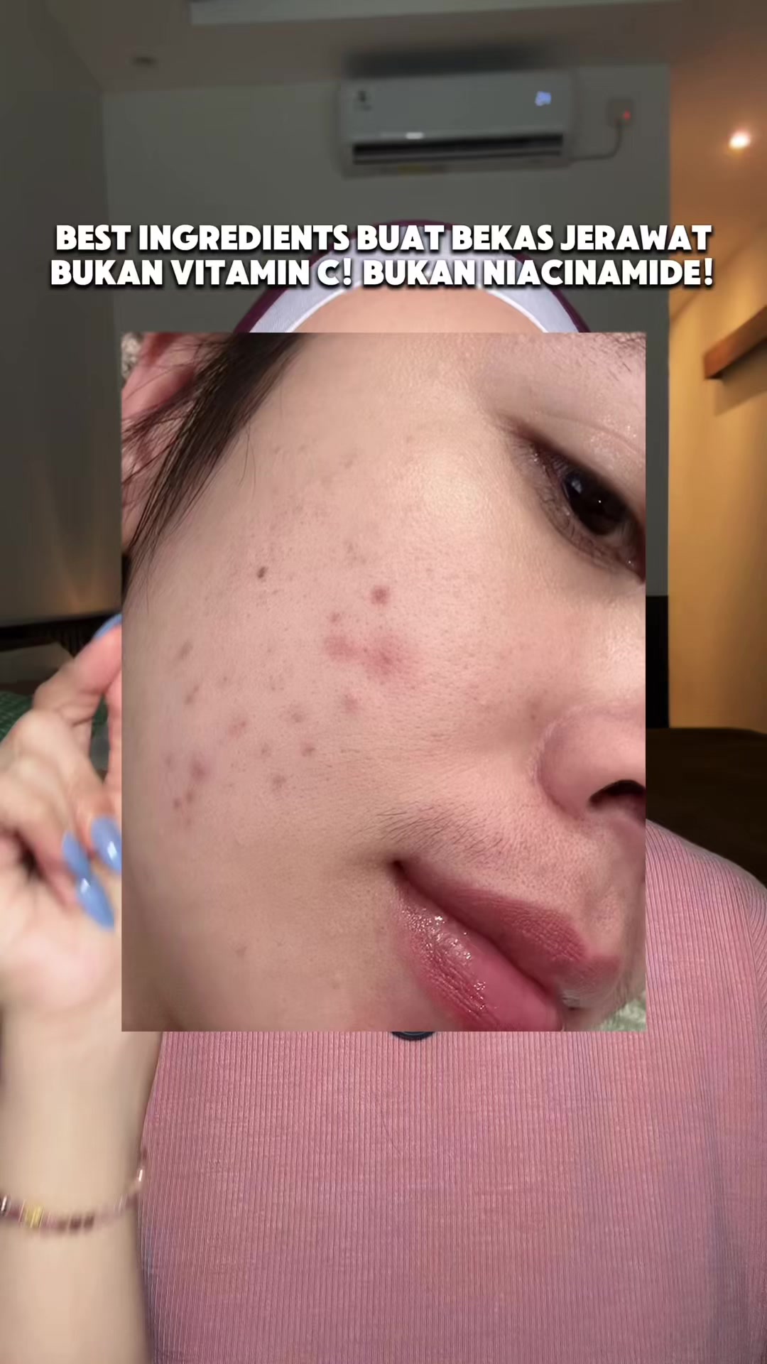 @Nonatyas