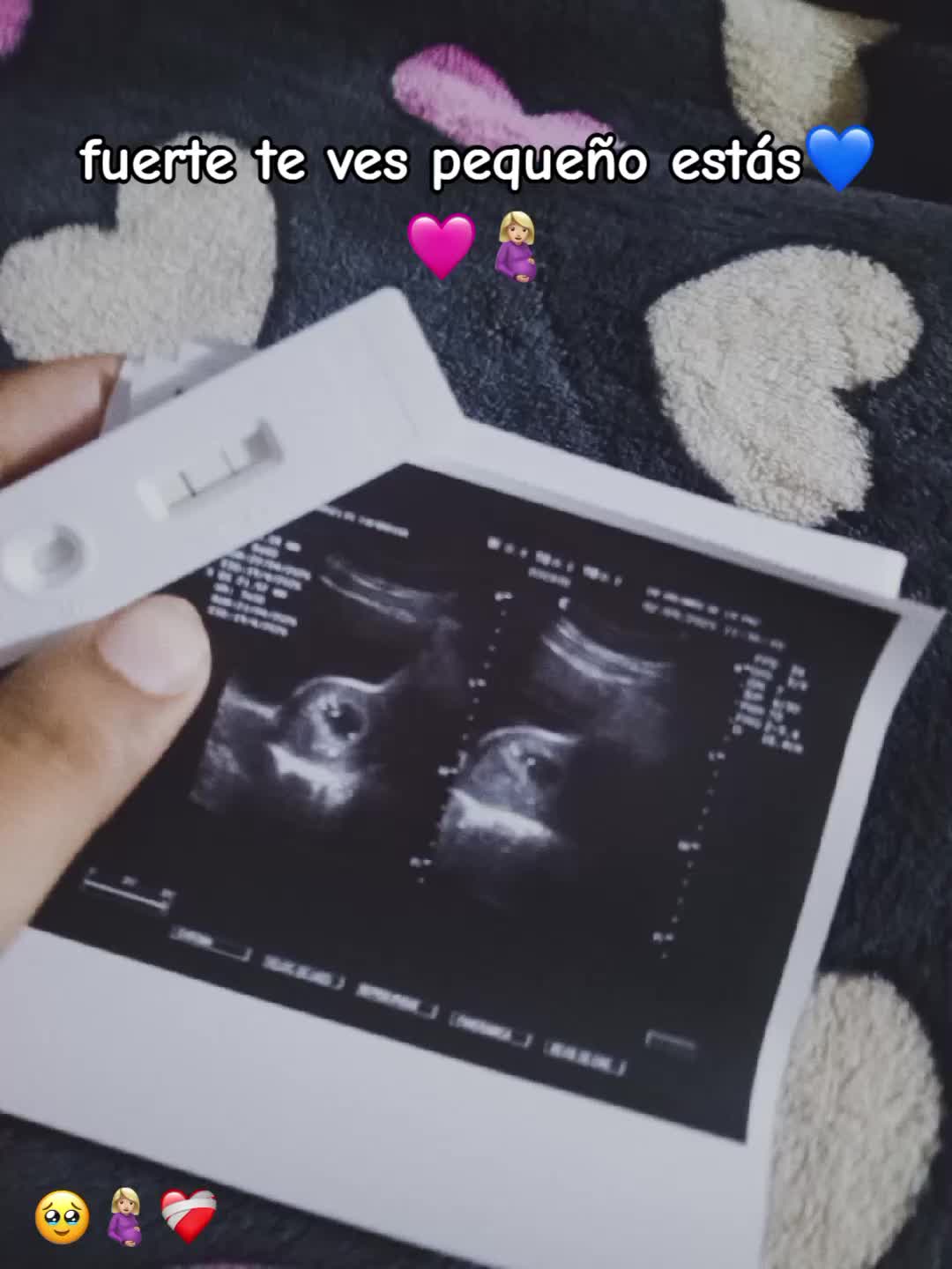 @Yorge👸🏻🖤💘