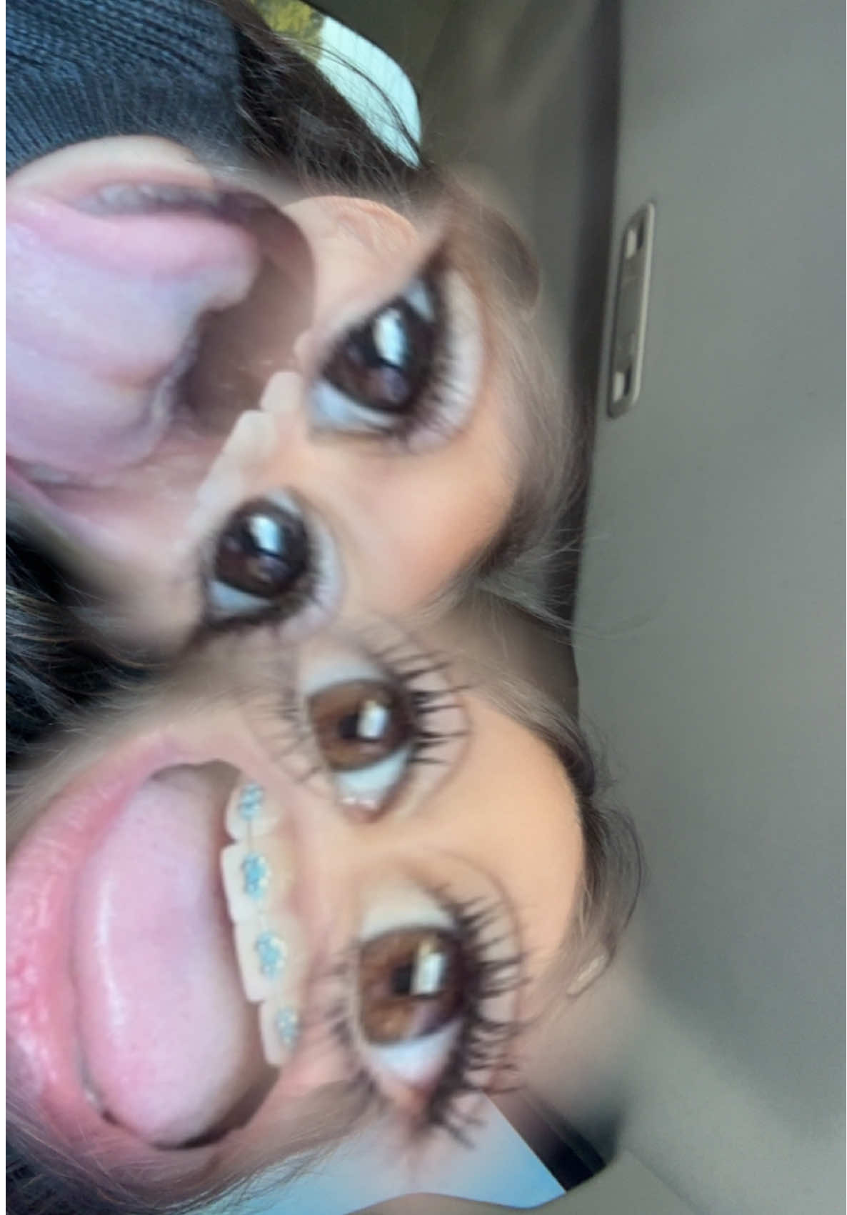 @Aylen.