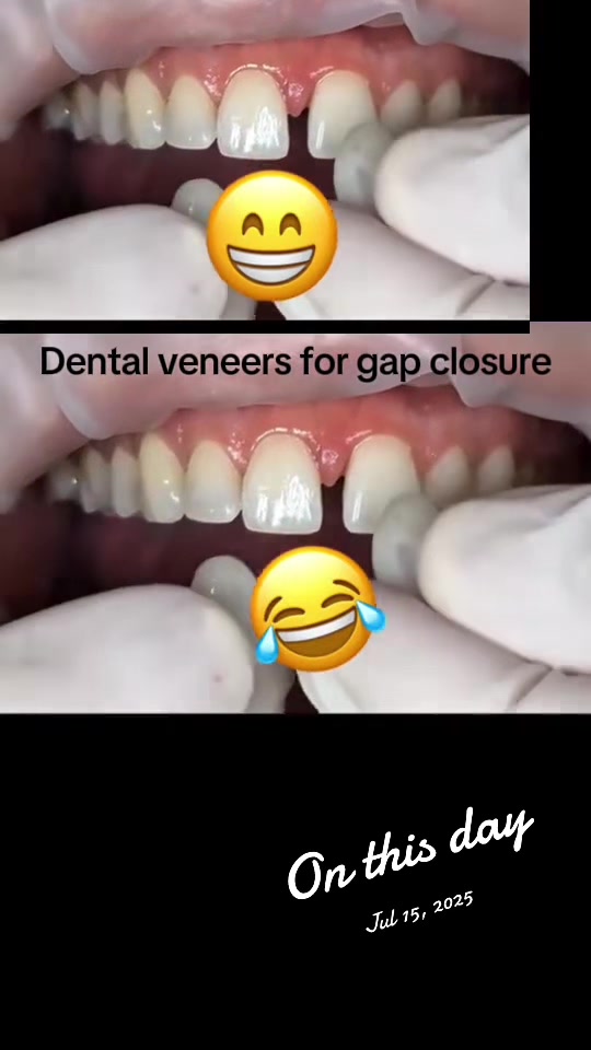 @Dr~MUJUNI 🦷🇺🇬✅