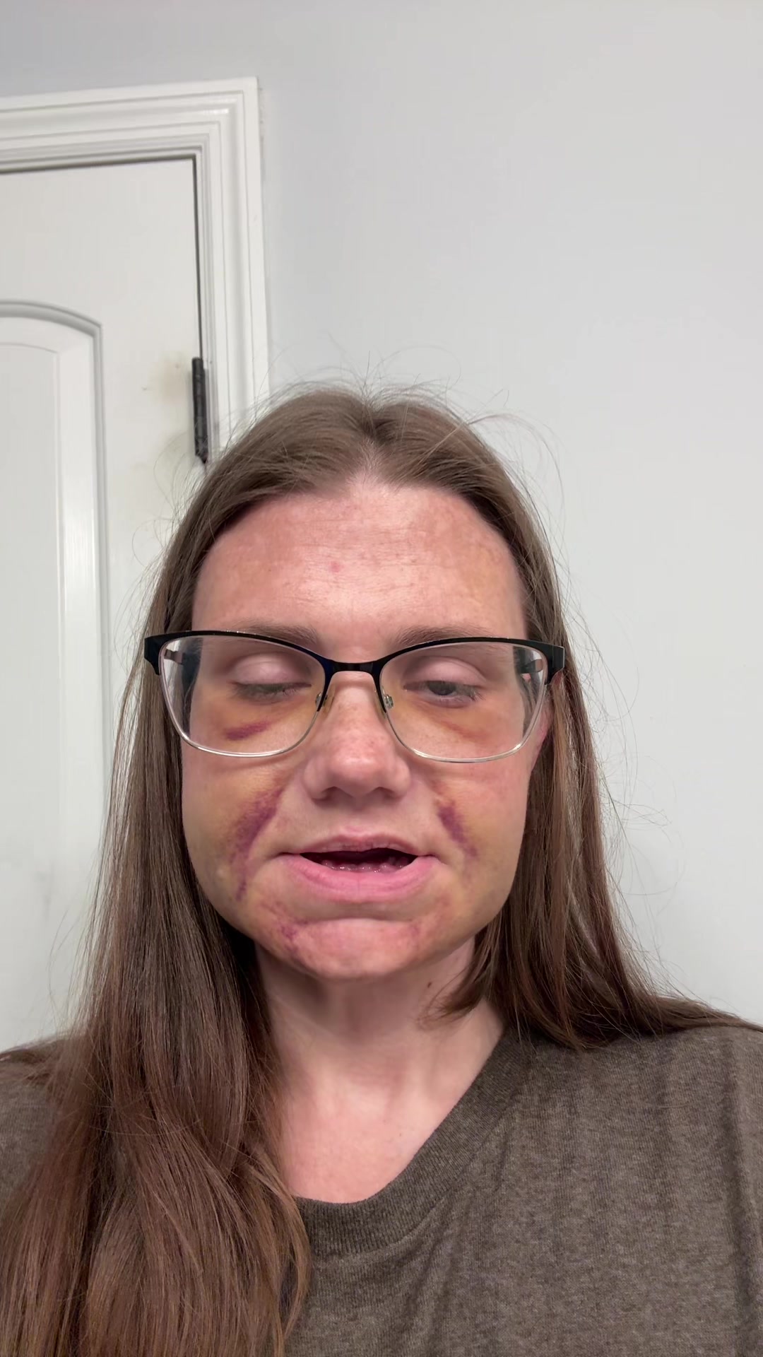 @libby_lew | Denture Princess