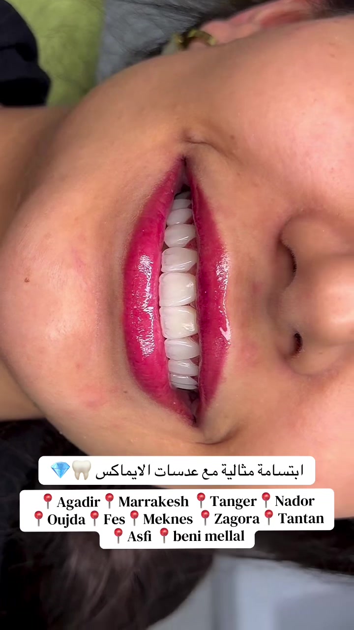 @brightsmileee1