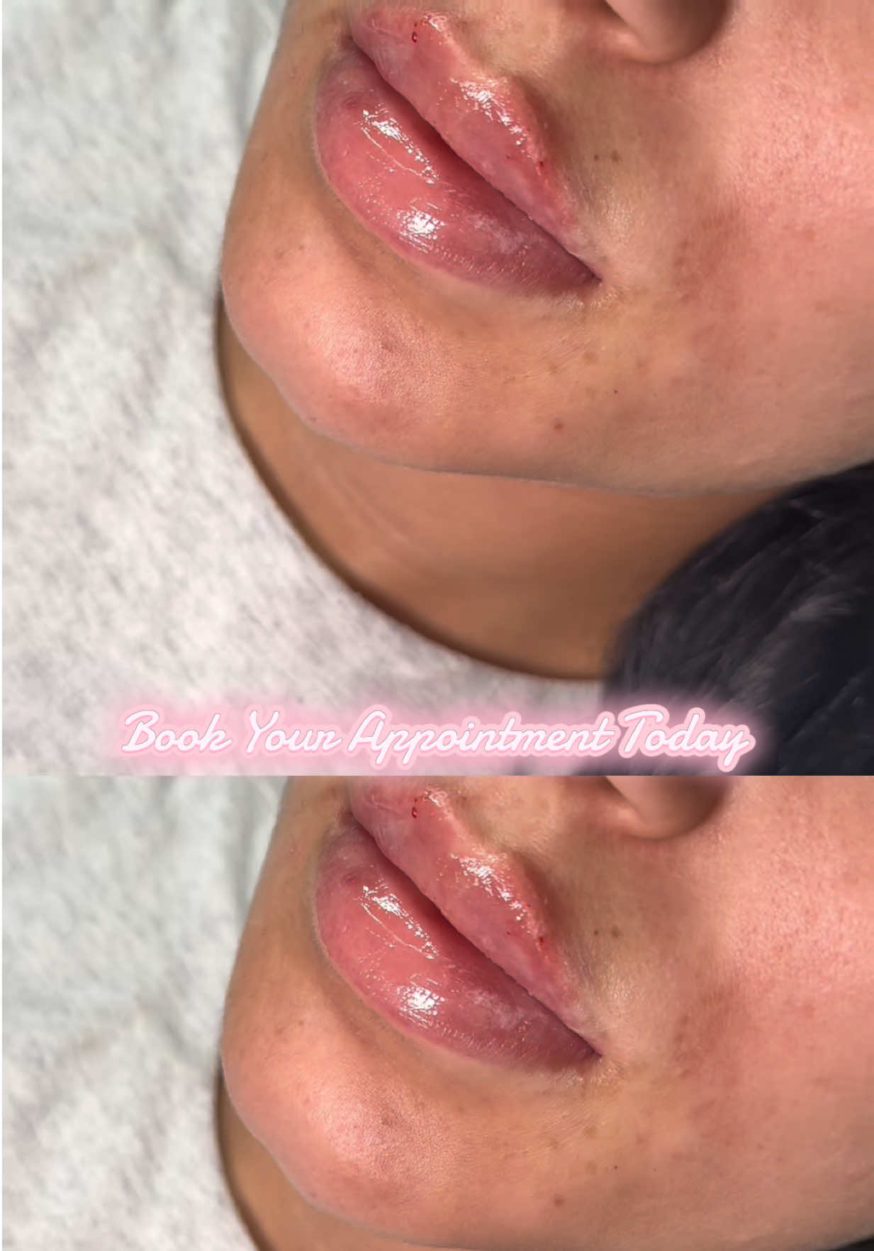 @Lips