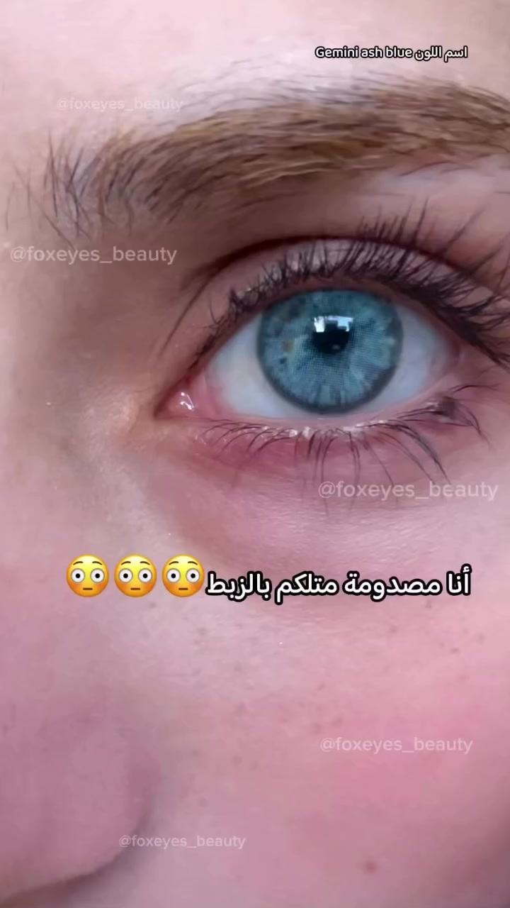 @Lolo. Lenses