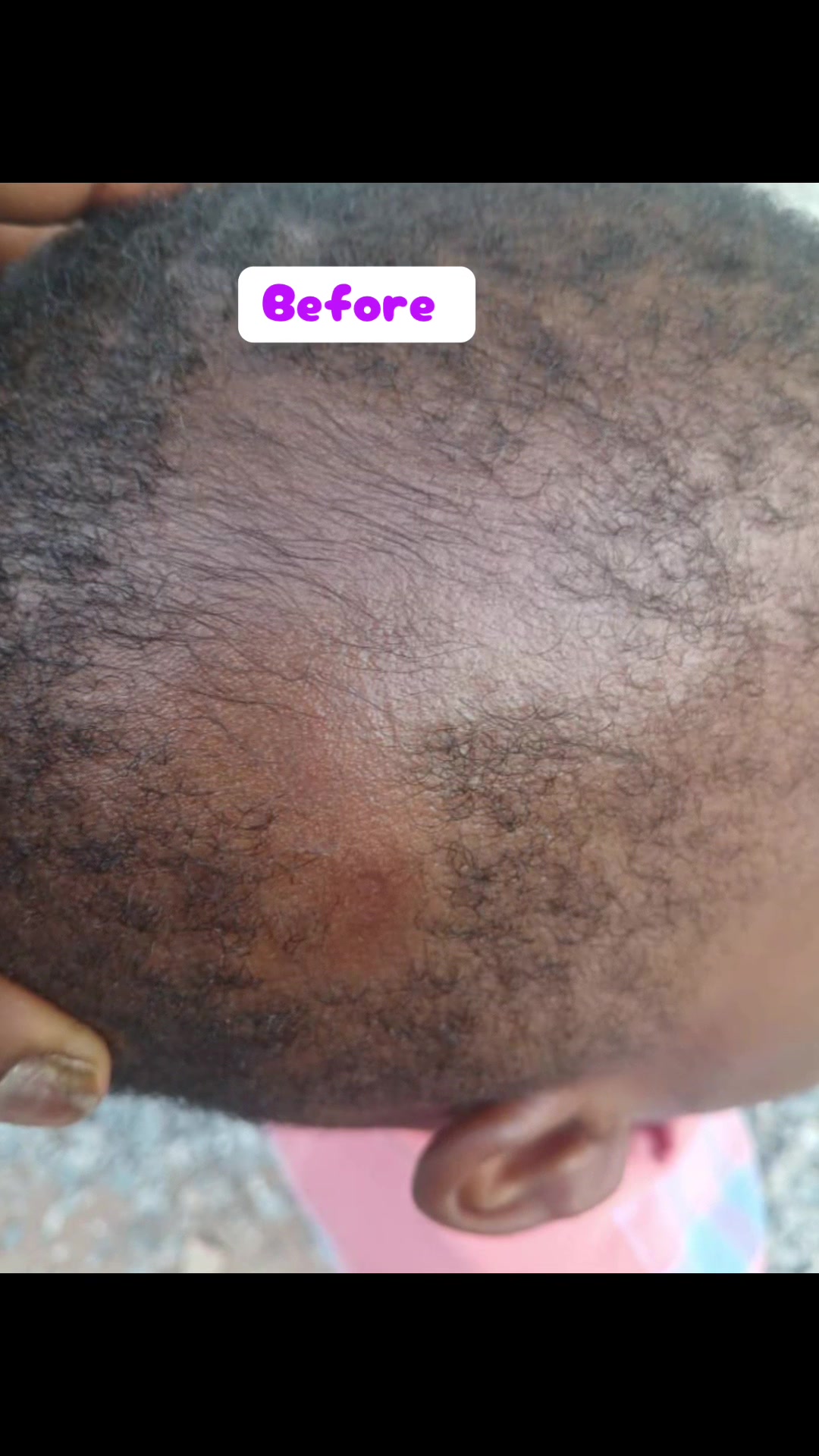 @NO.1HAIR GROWTH PRODUCTS