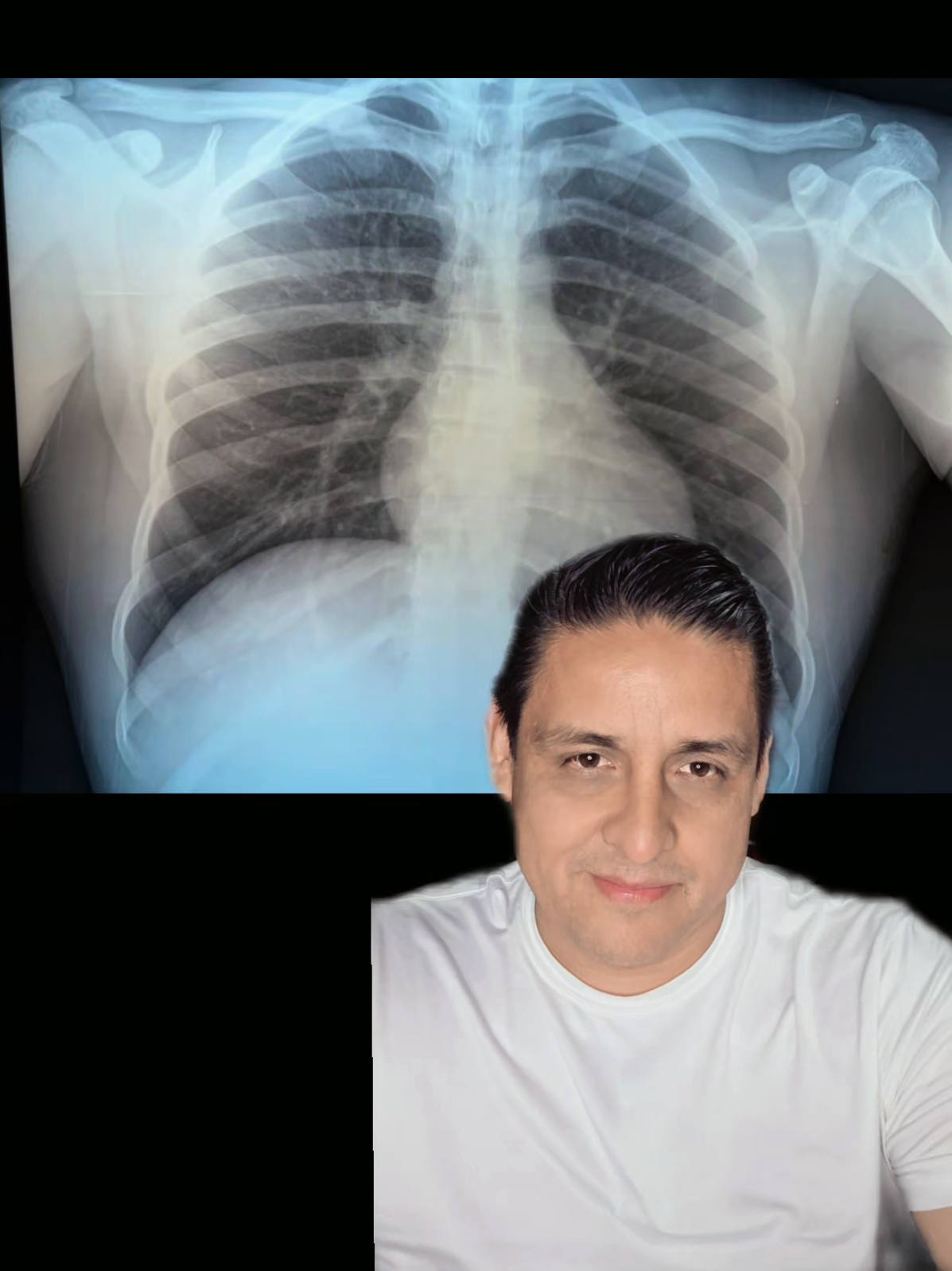 @Dr. Marco Antonio Reynaga C.