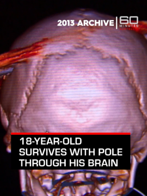@60 Minutes Australia