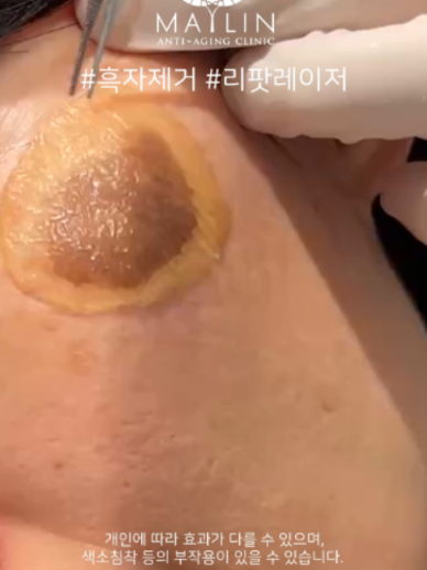 @메이린의원대구점