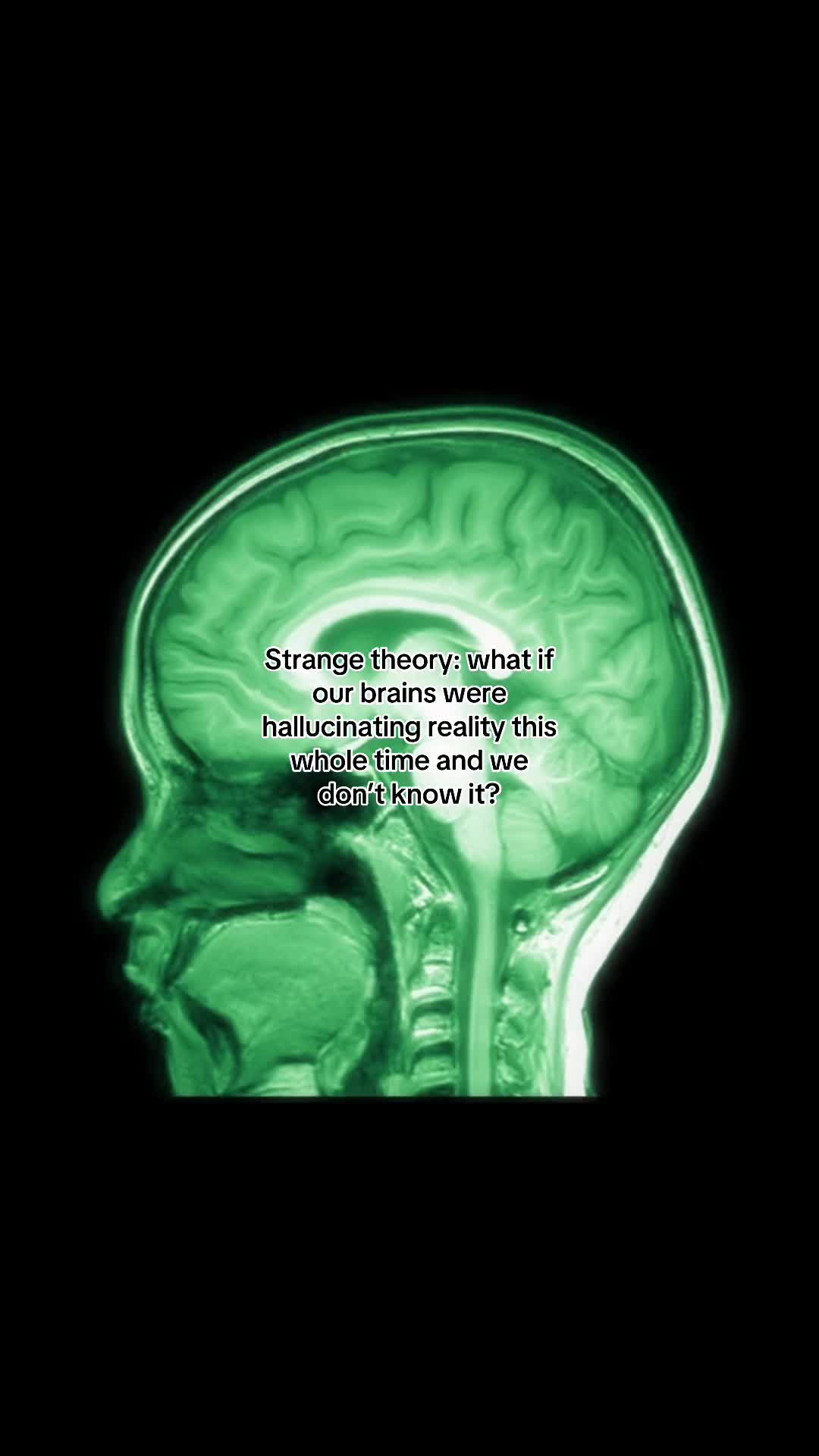 @Brainstormed