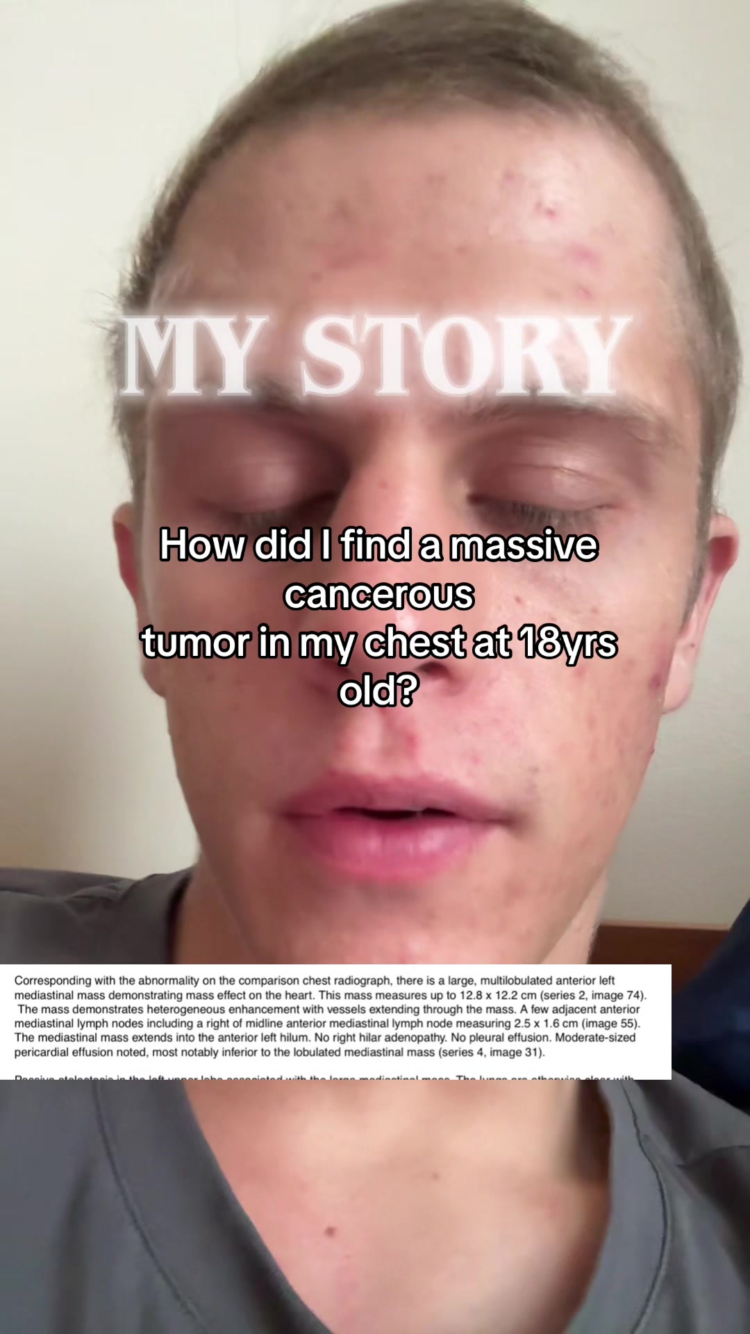 @Trace🎗️