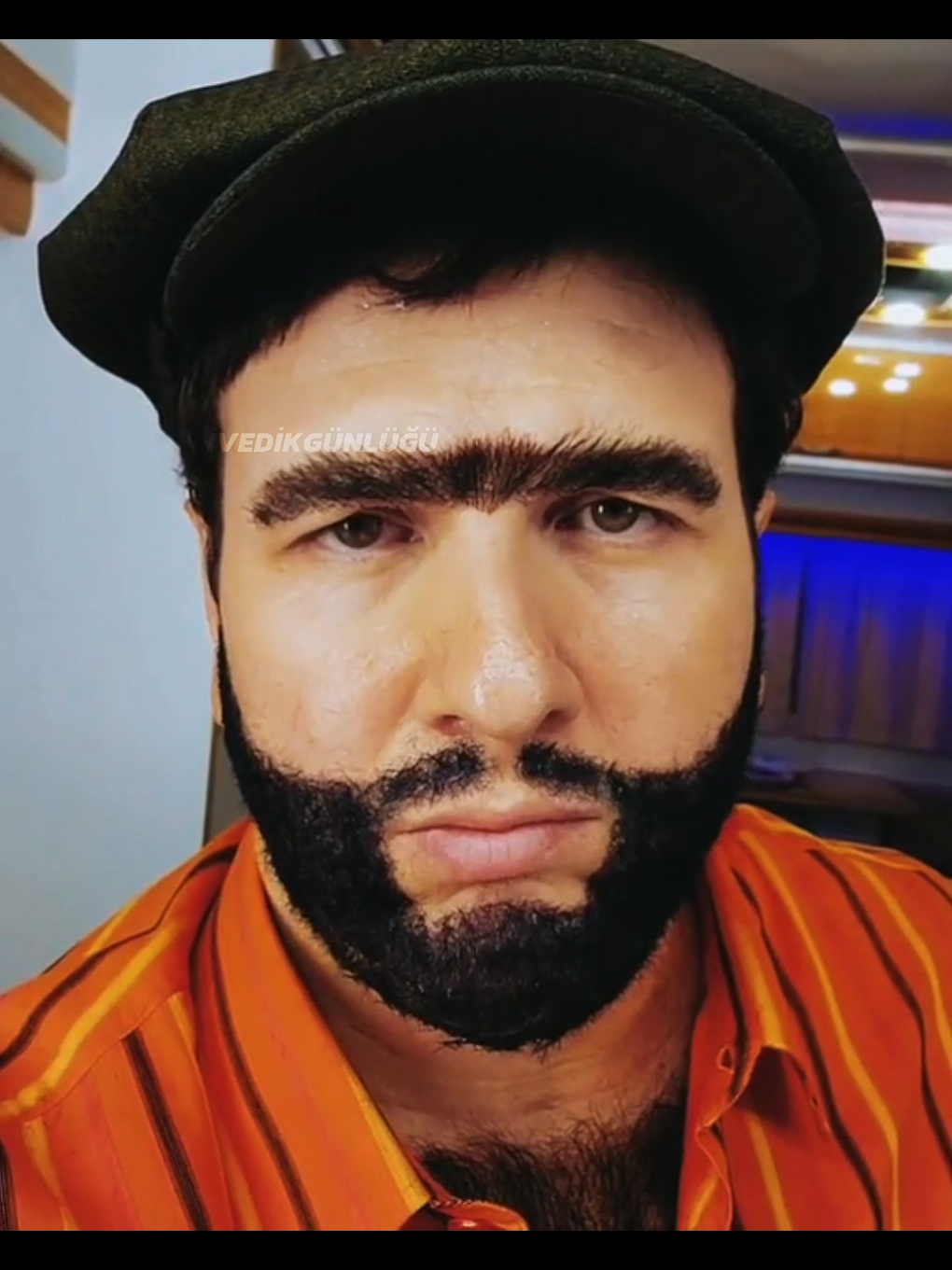 @İvedik G&uuml;nl&uuml;ğ&uuml;