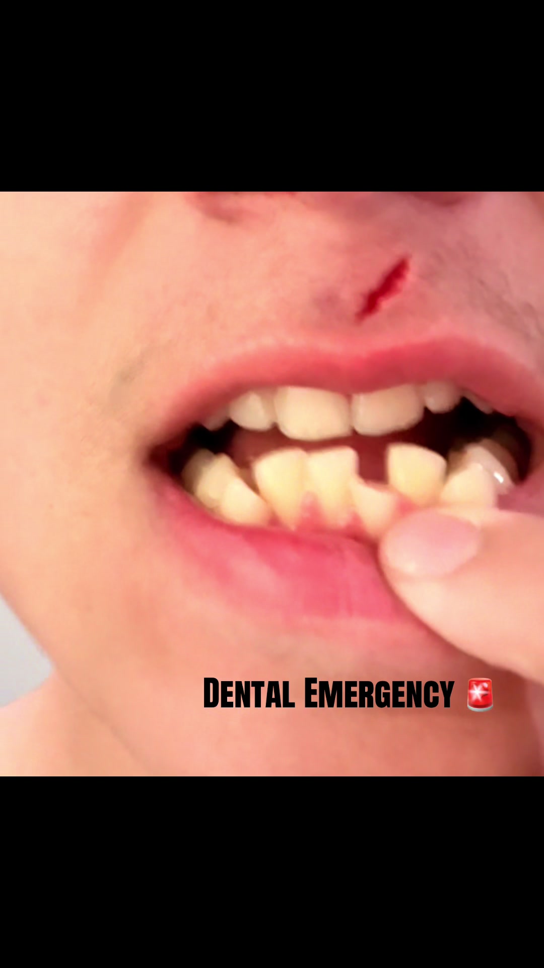 @Italian Smiles Dentistry