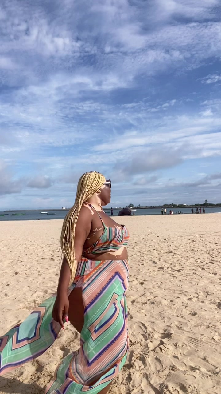 @Thevitiligogirl