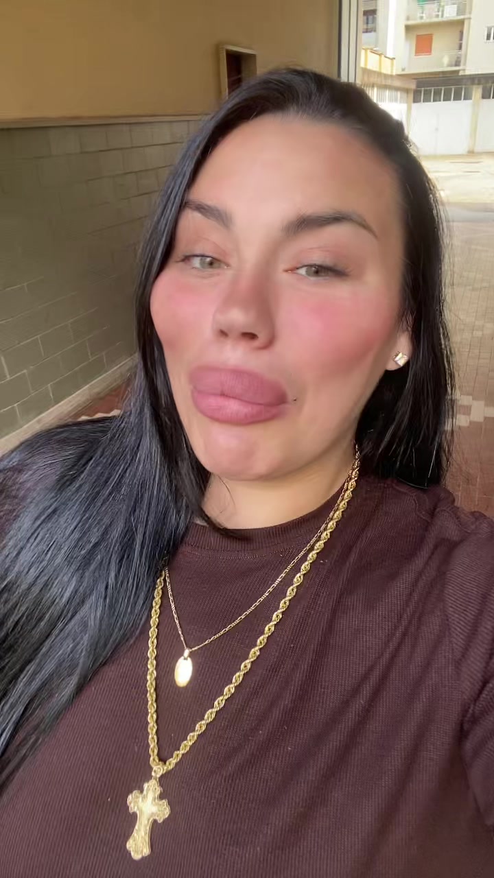 @Alessia albino