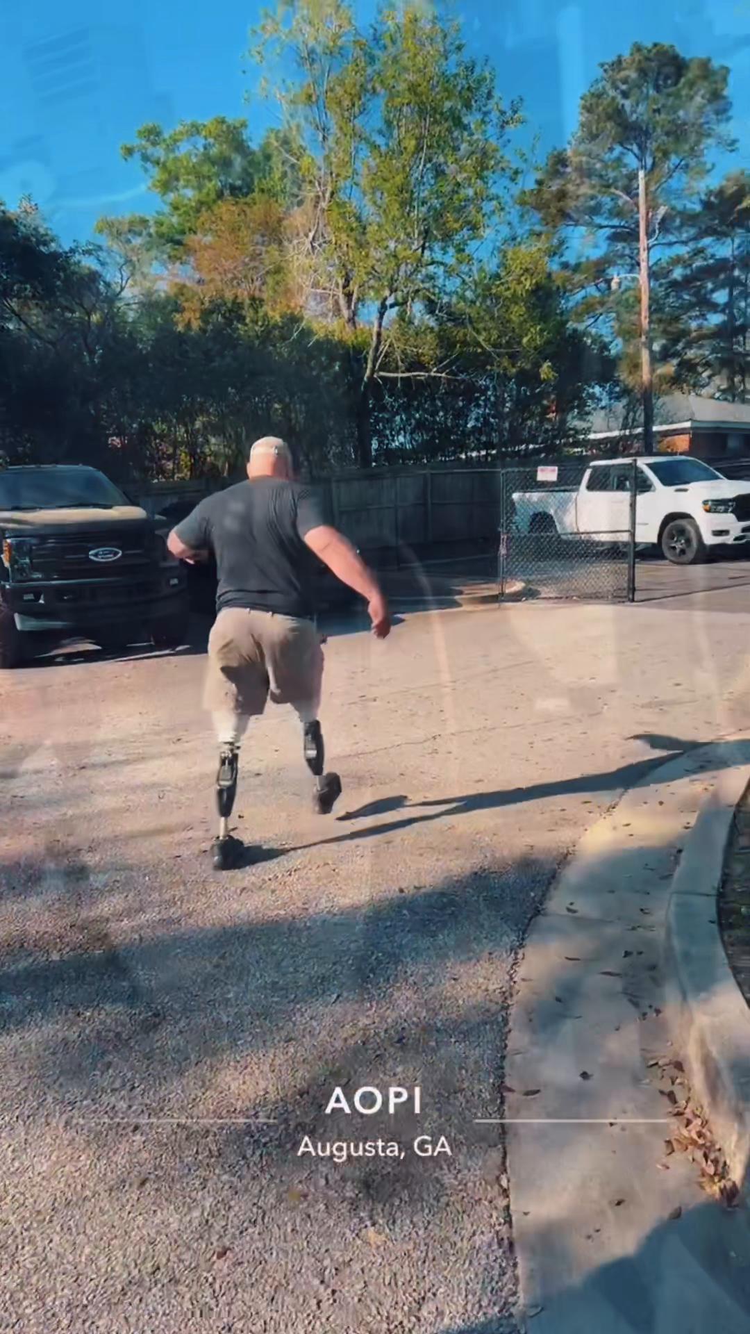 @AOPI_Prosthetics and Ortho