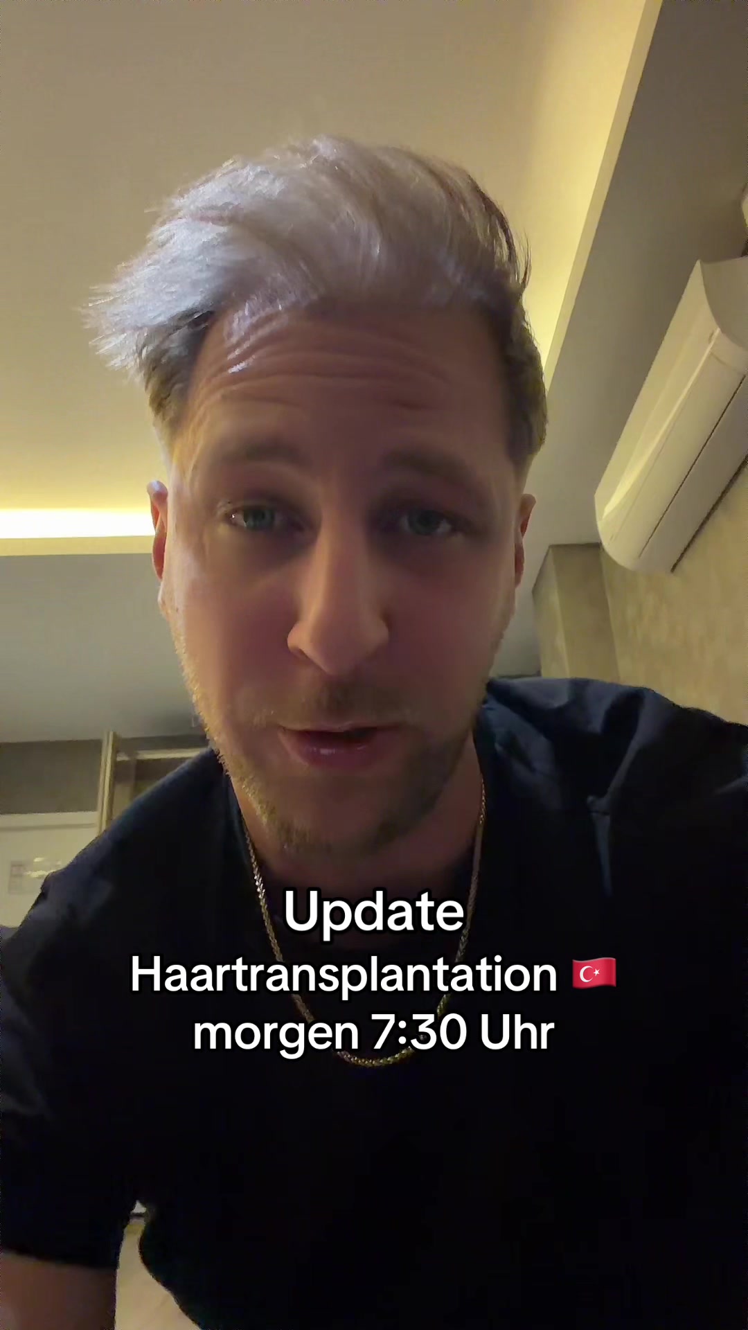 @Mr. Hairtransplant