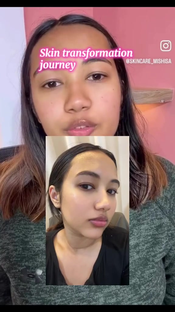 @MISHISA