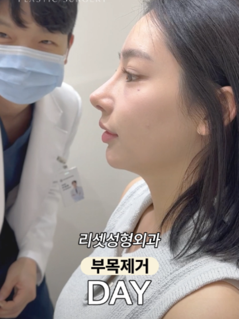@리셋성형외과