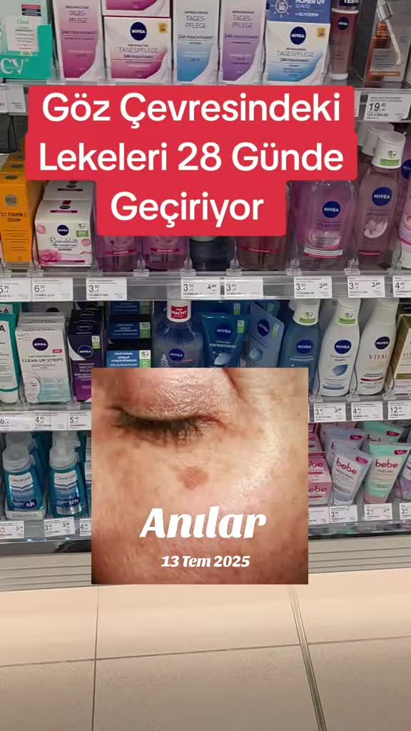 @Gurbet Ana