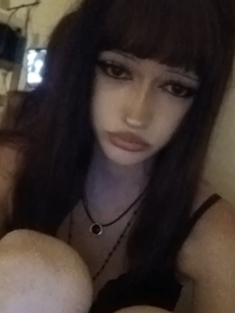 @777