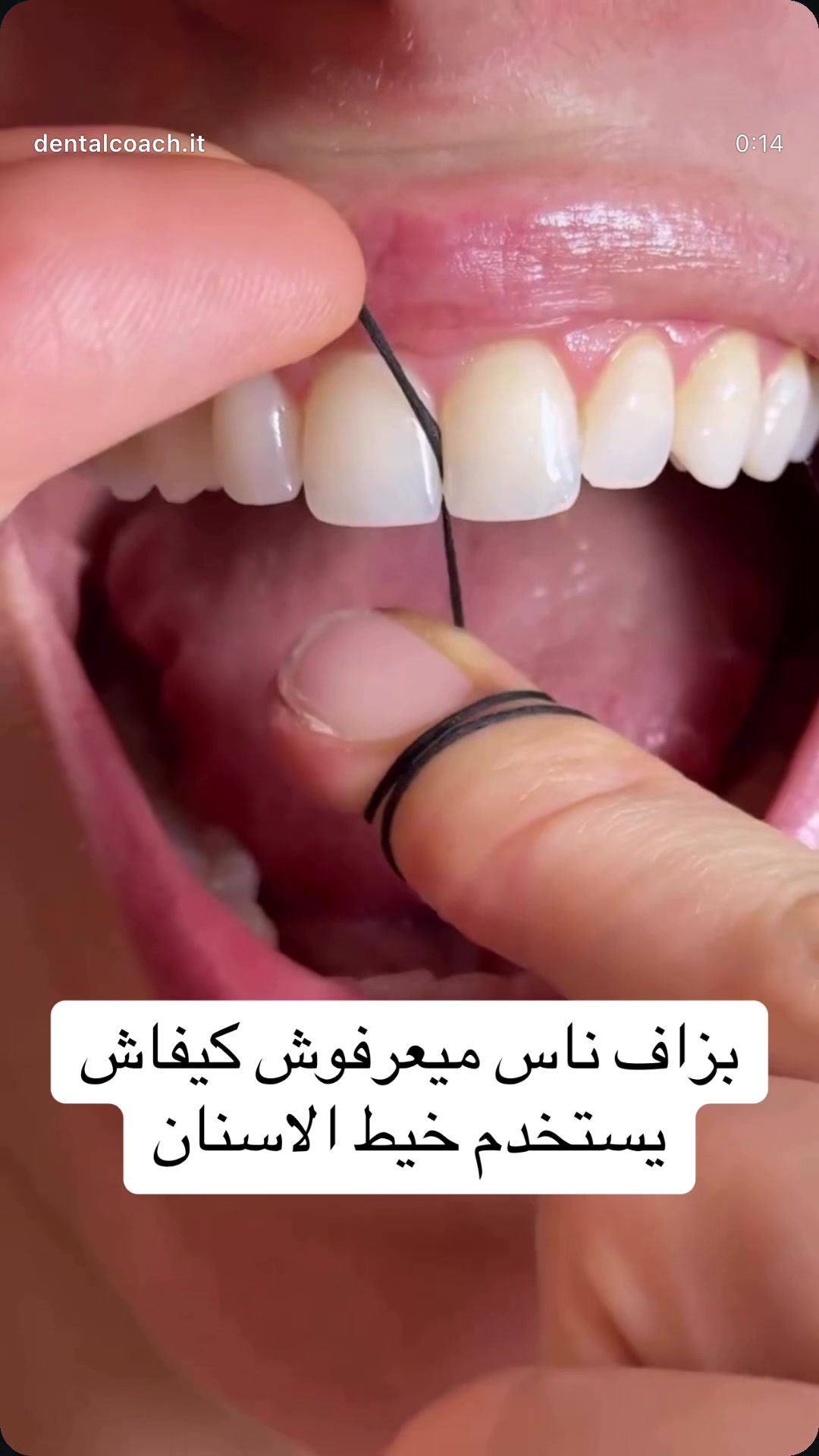 @Varietta Dental Care