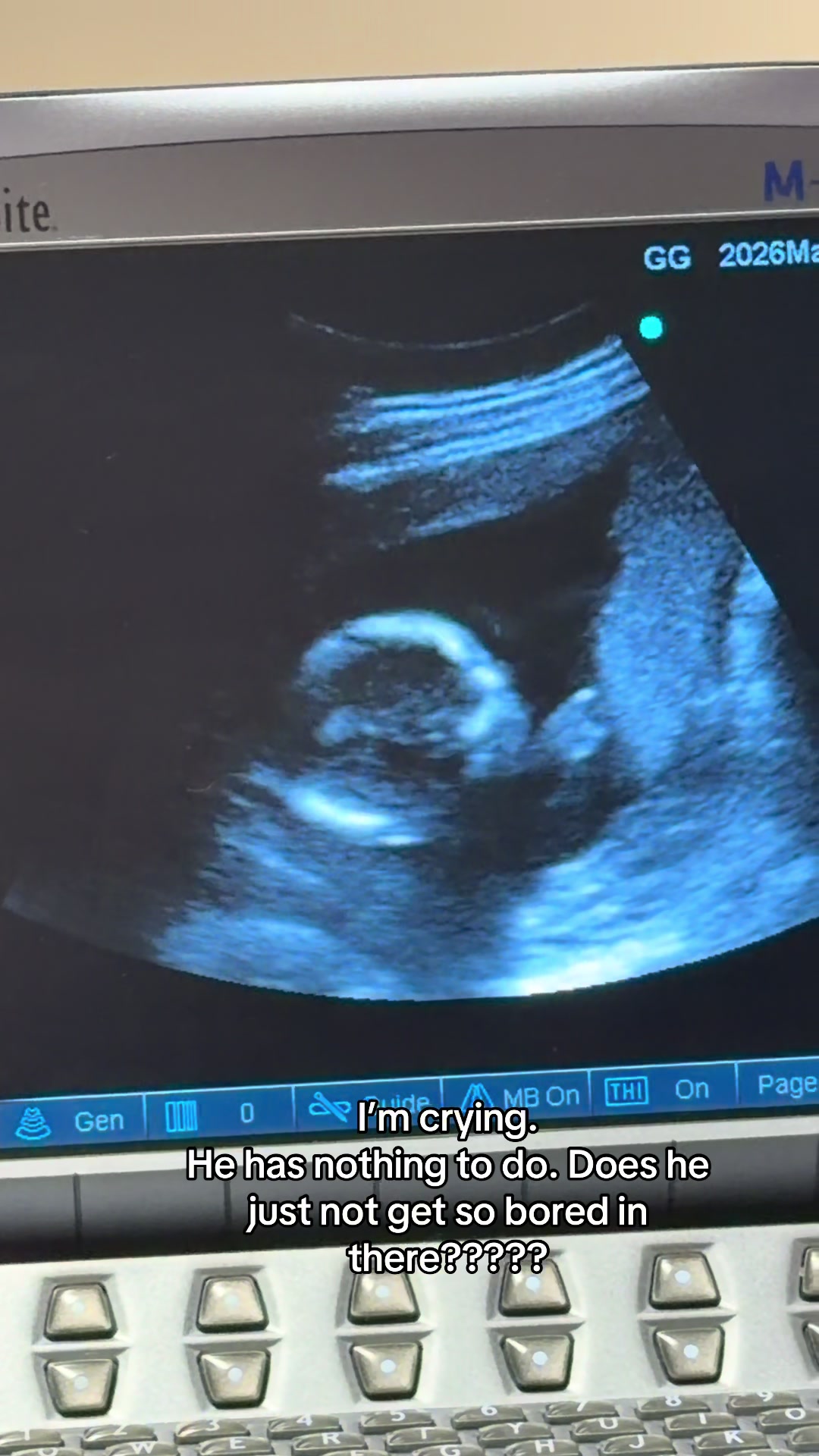 @Alexis