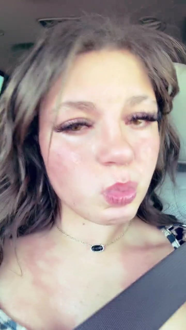 @💫