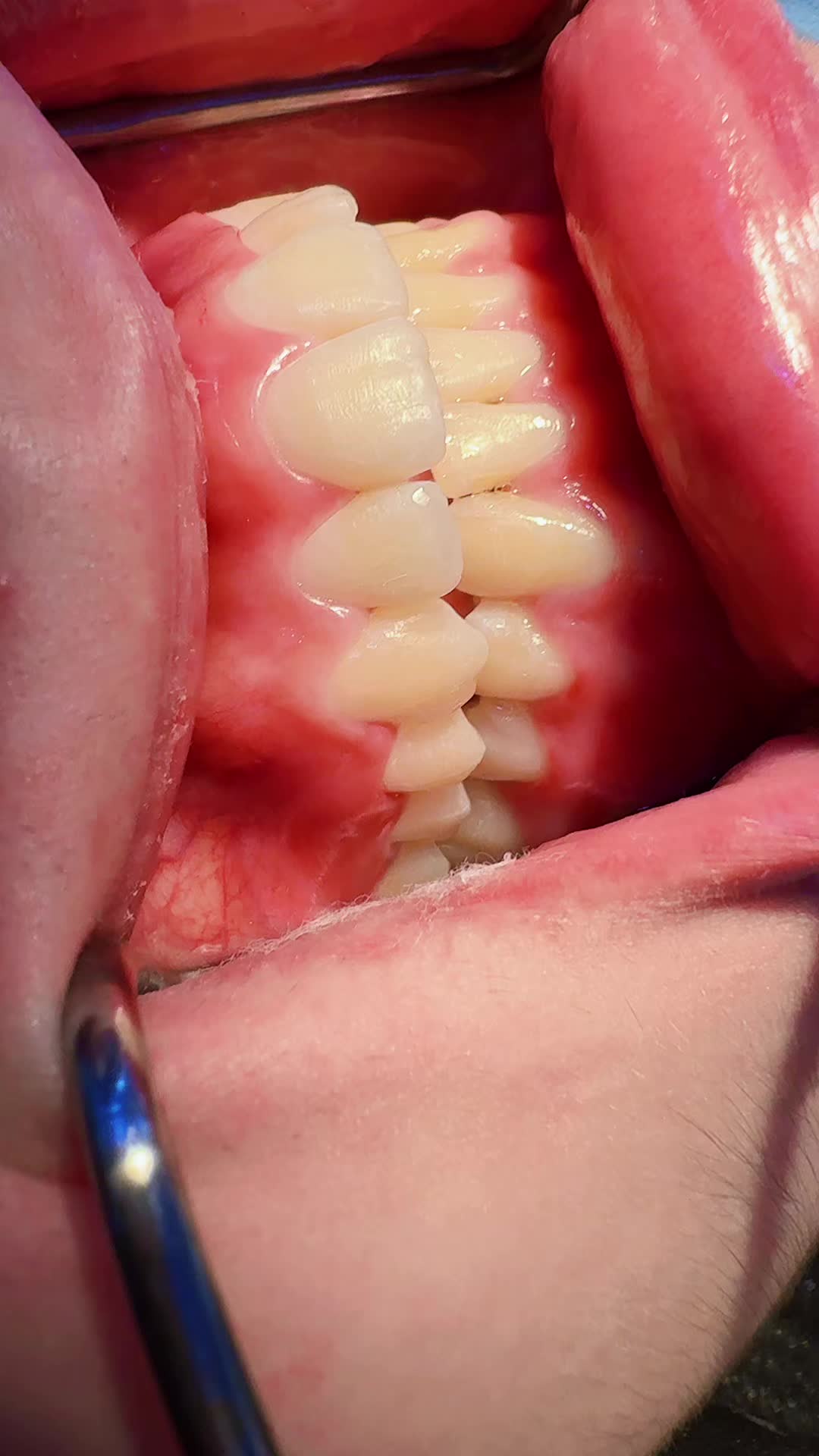 @Dr RahmatullahDental surgeon