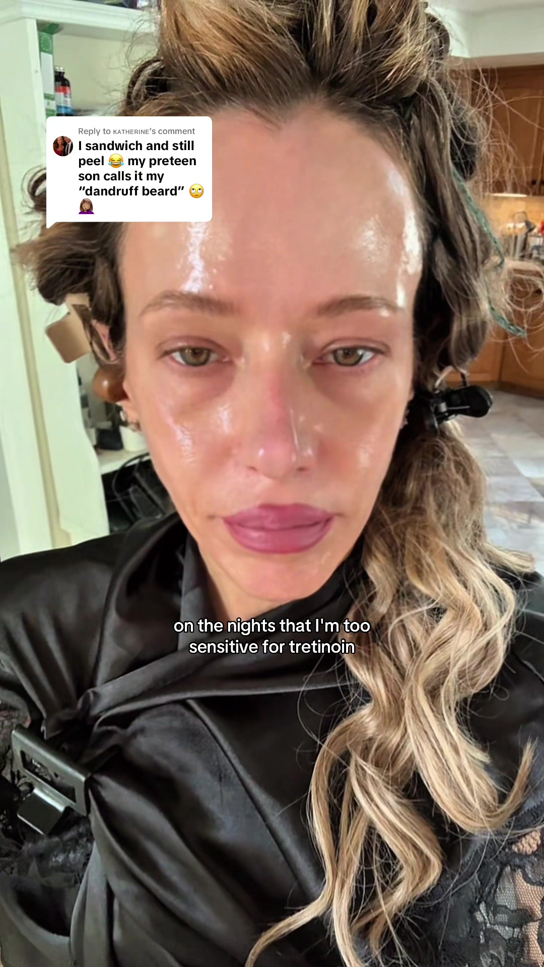 @Ally K
