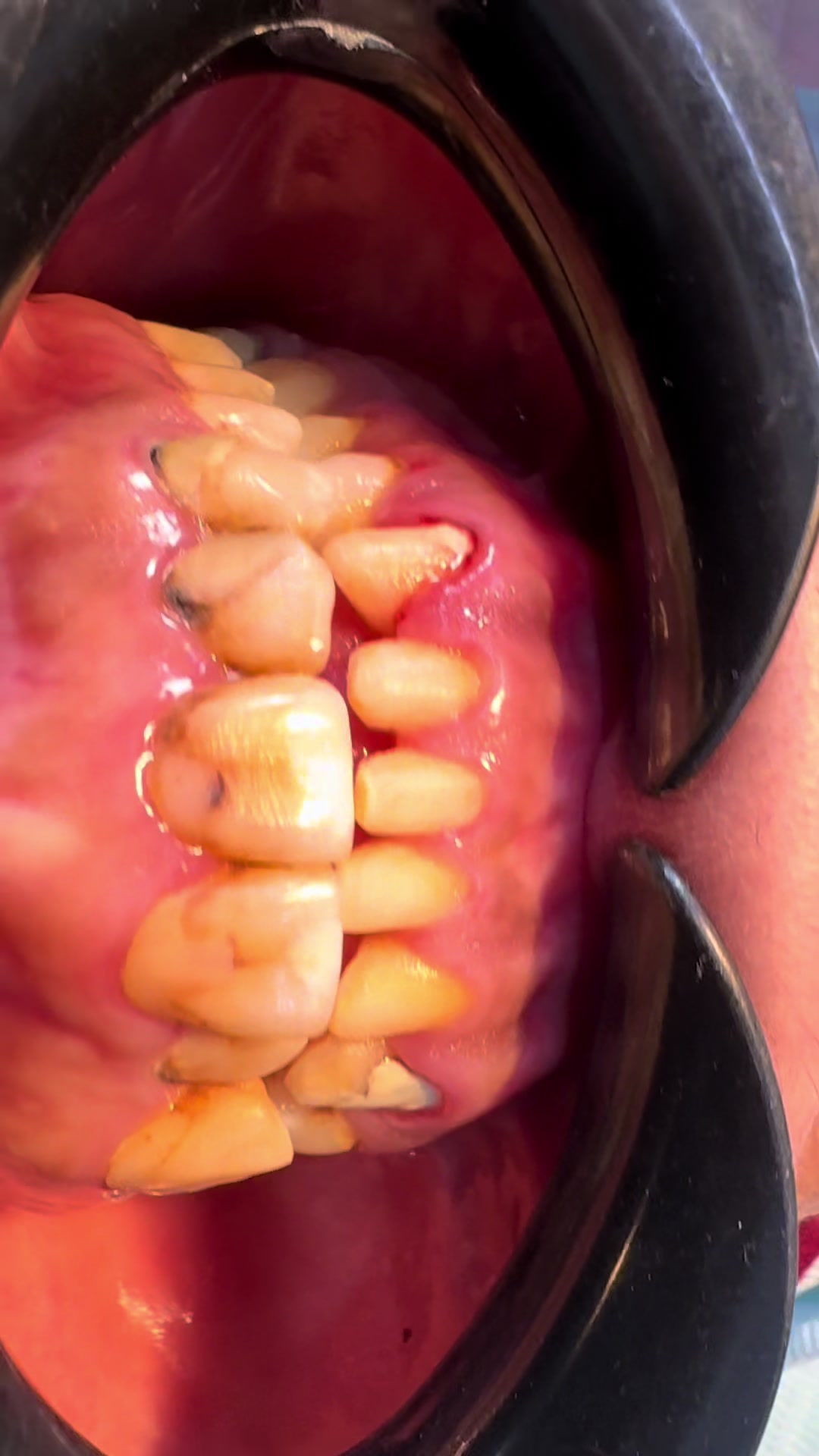 @Dr RahmatullahDental surgeon