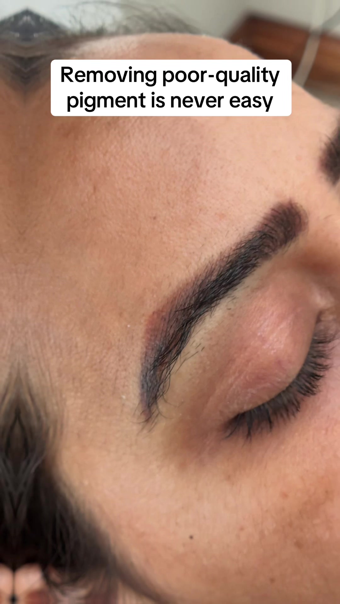 @Permanent Makeup & Removal