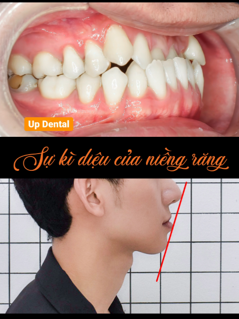 @Nha khoa niềng răng Up Dental