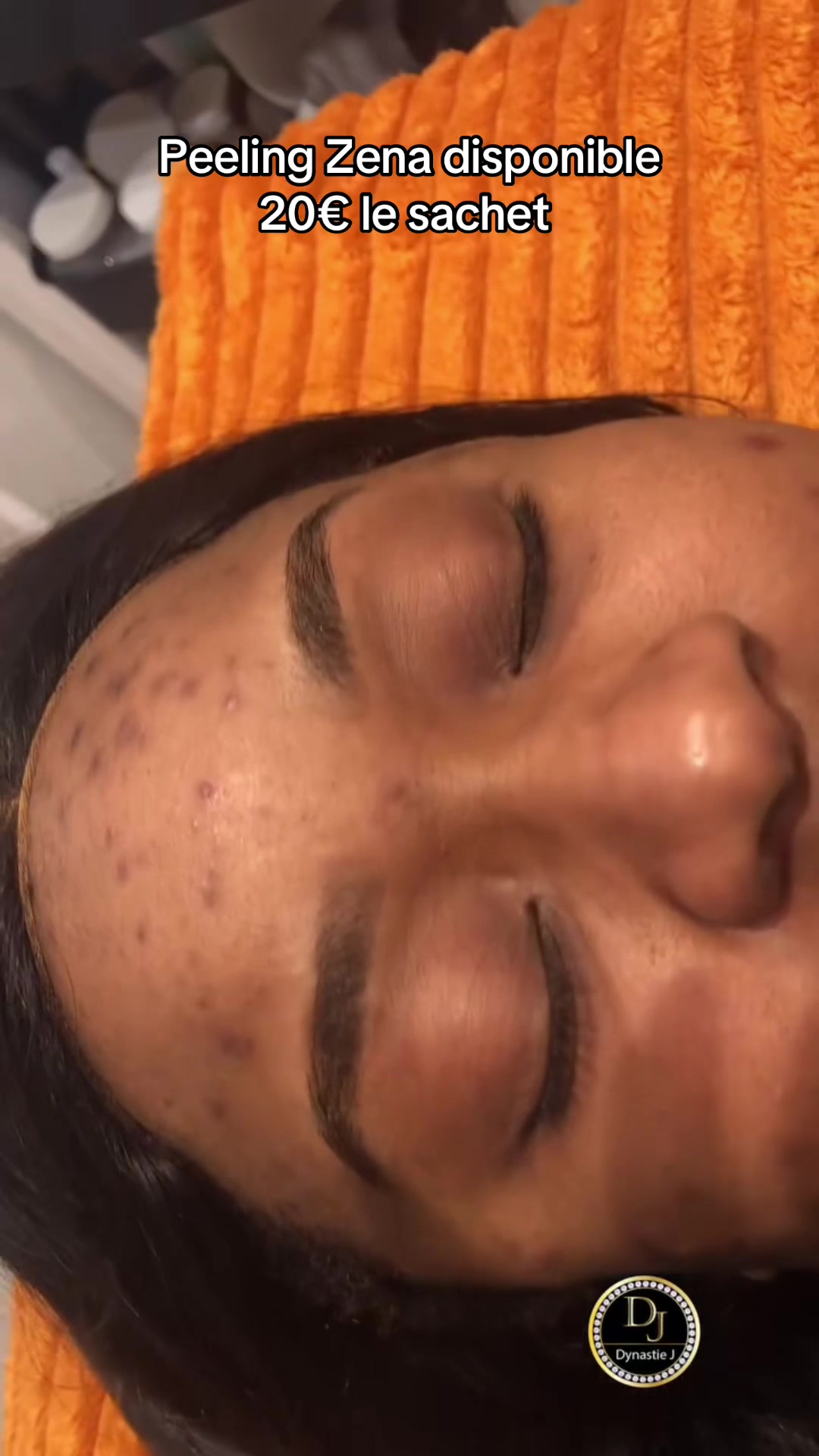 @peeling_zena