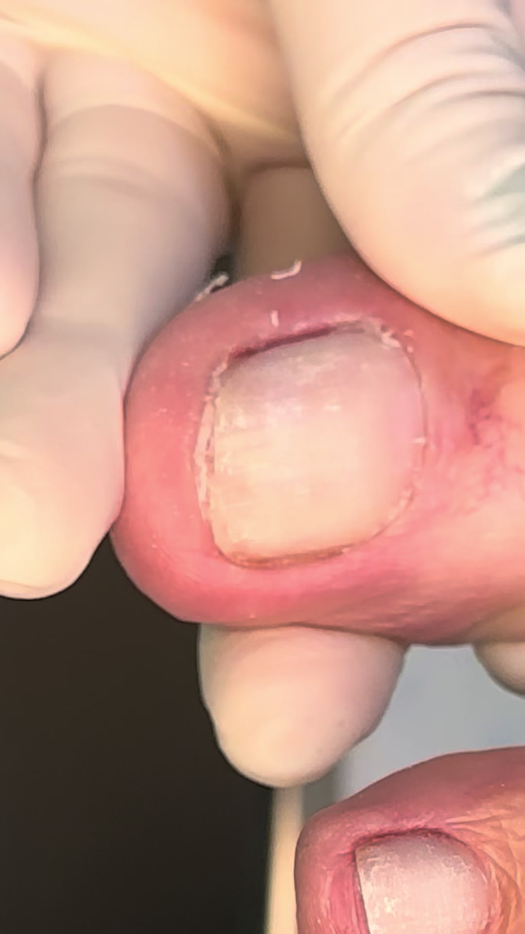 @Podocurebr