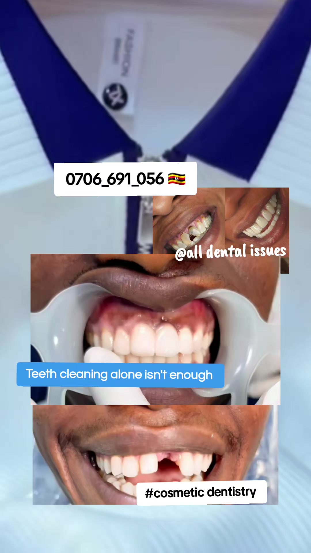 @Dental studio.🦷.Kampala