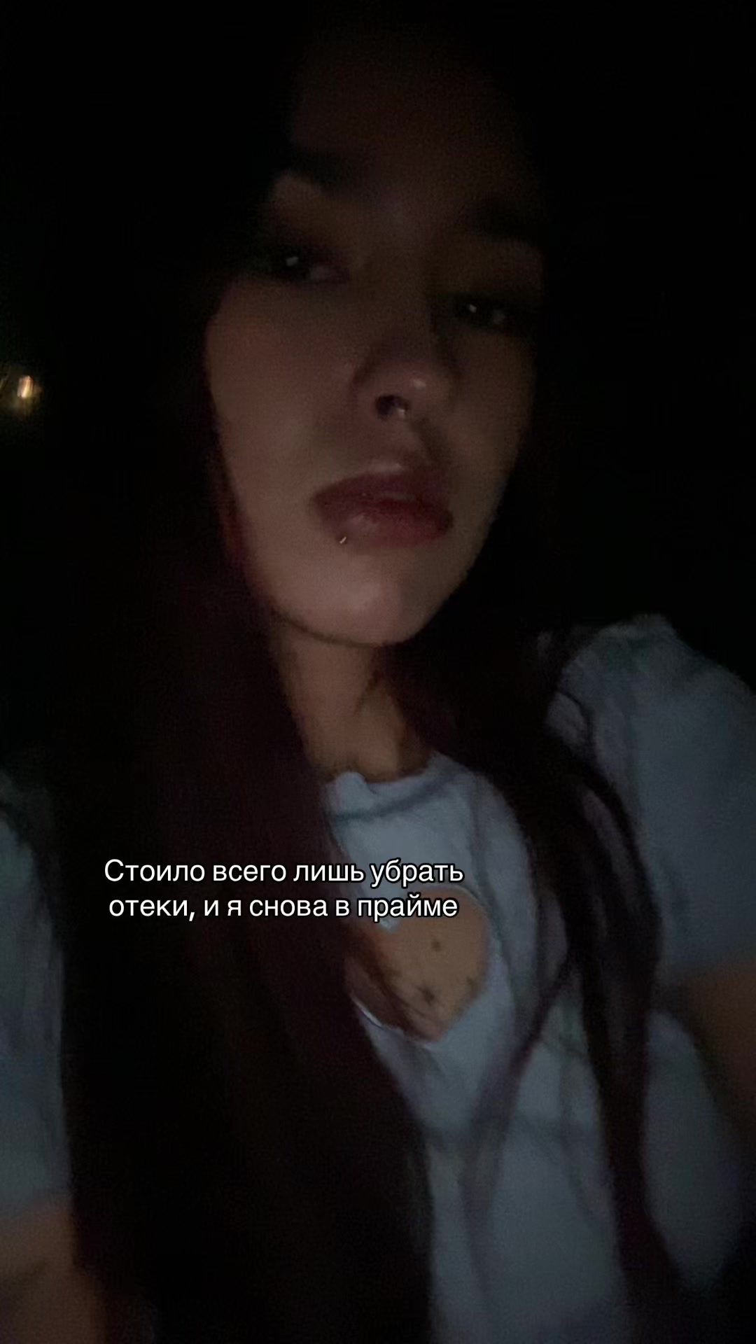 @1___xz____1
