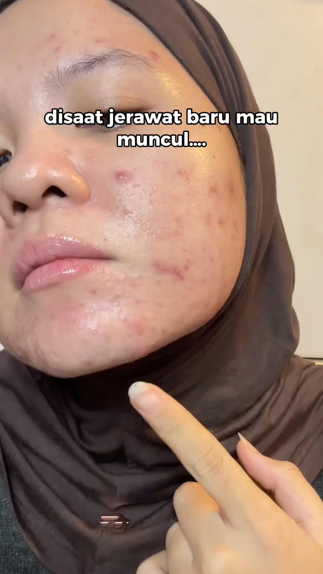 @devaniraa