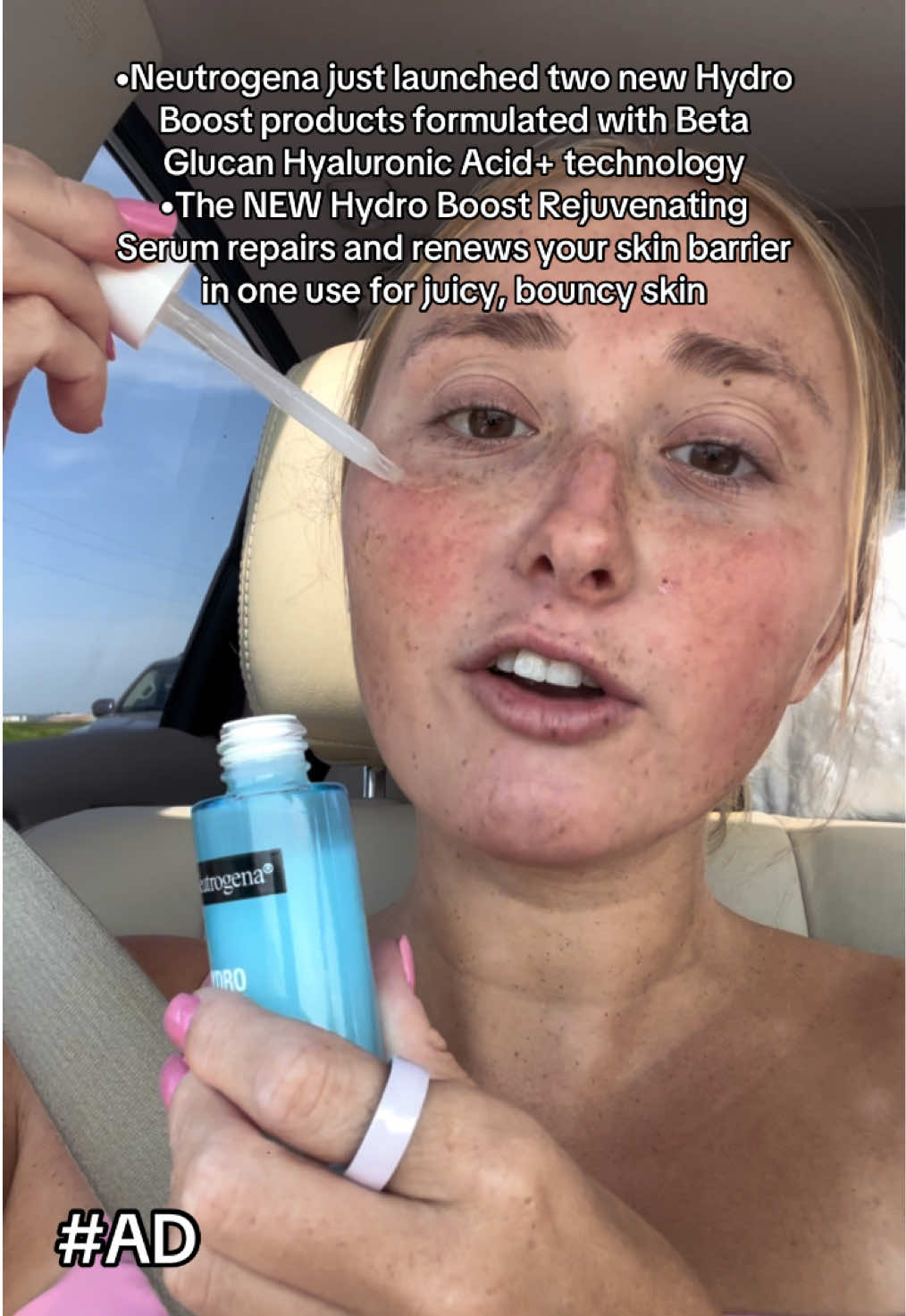@abzz