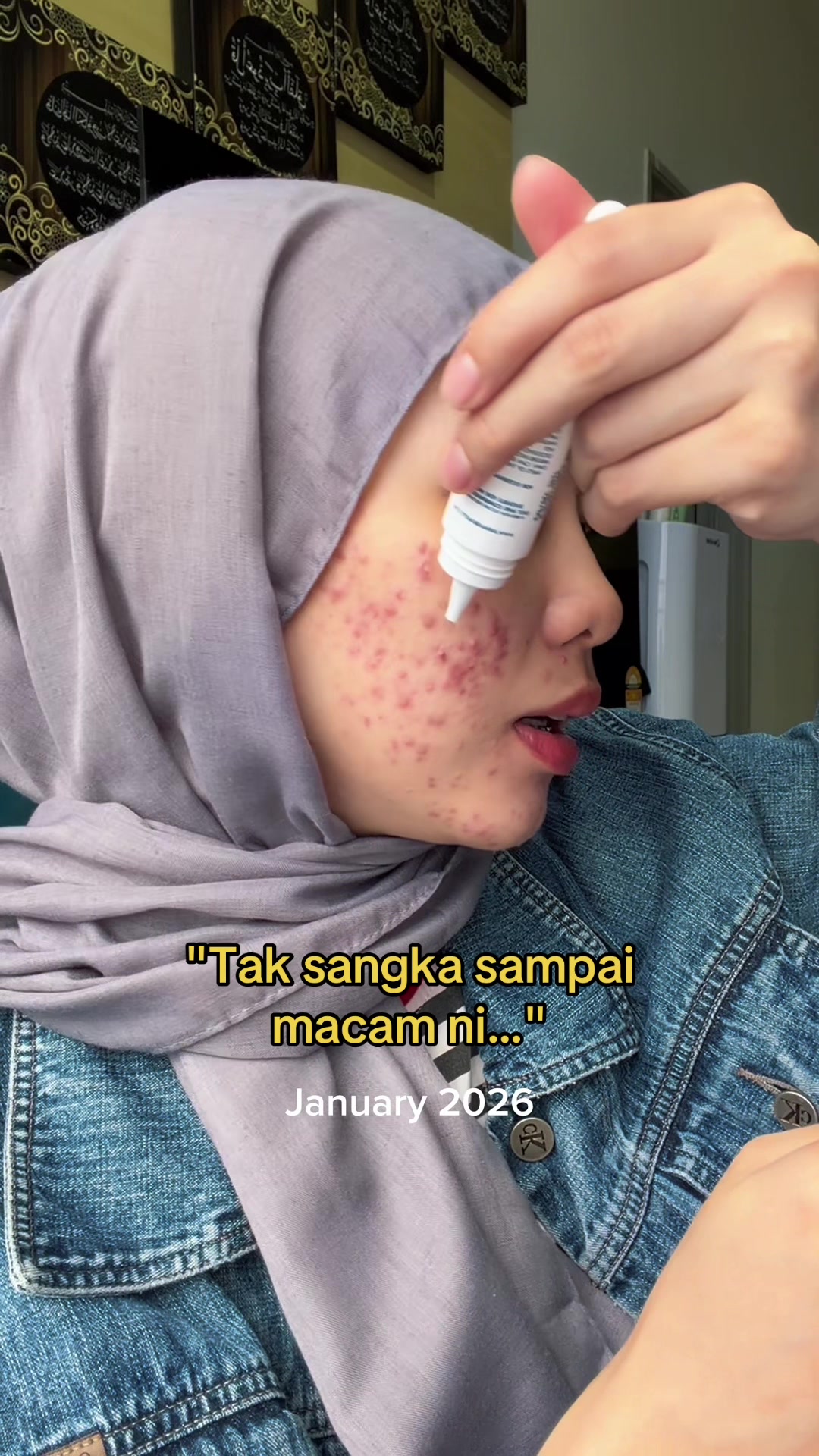 @AINAA
