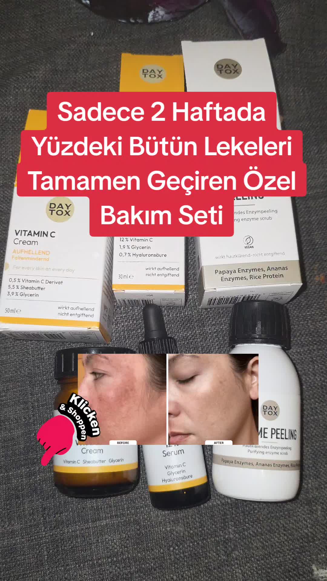 @Gurbetana27