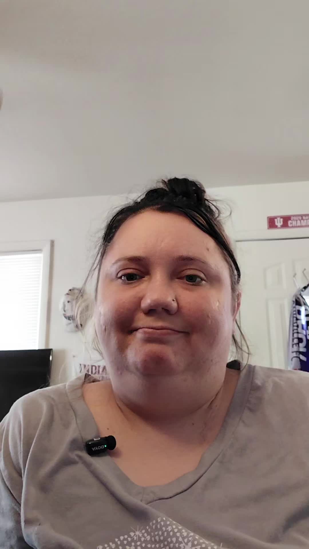 @LimblessLife