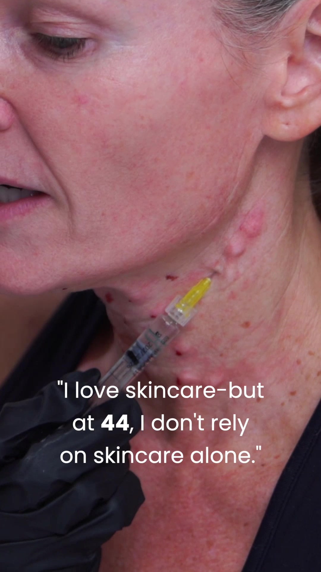 @DIY SKINCARE