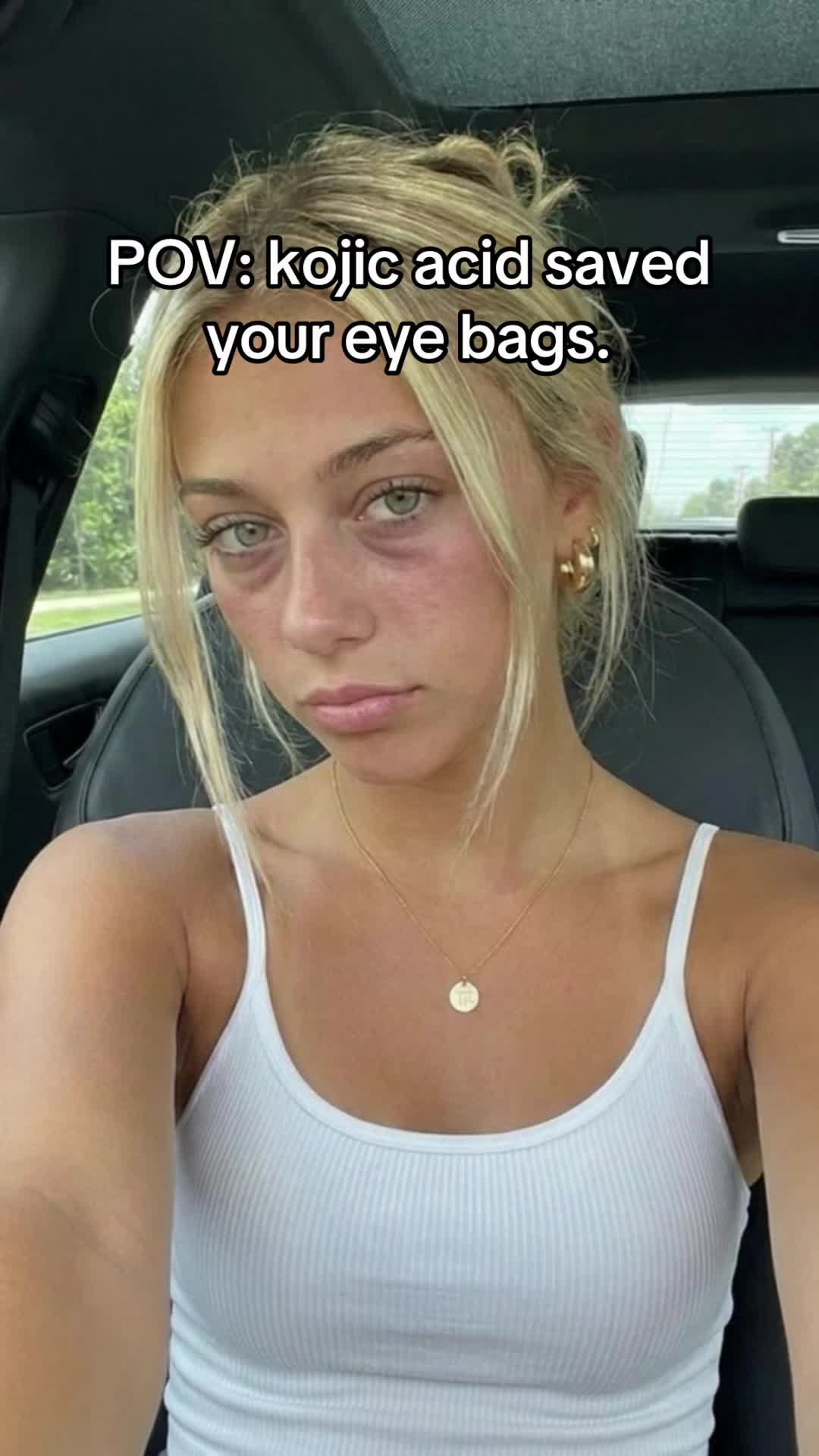 @glowkayls