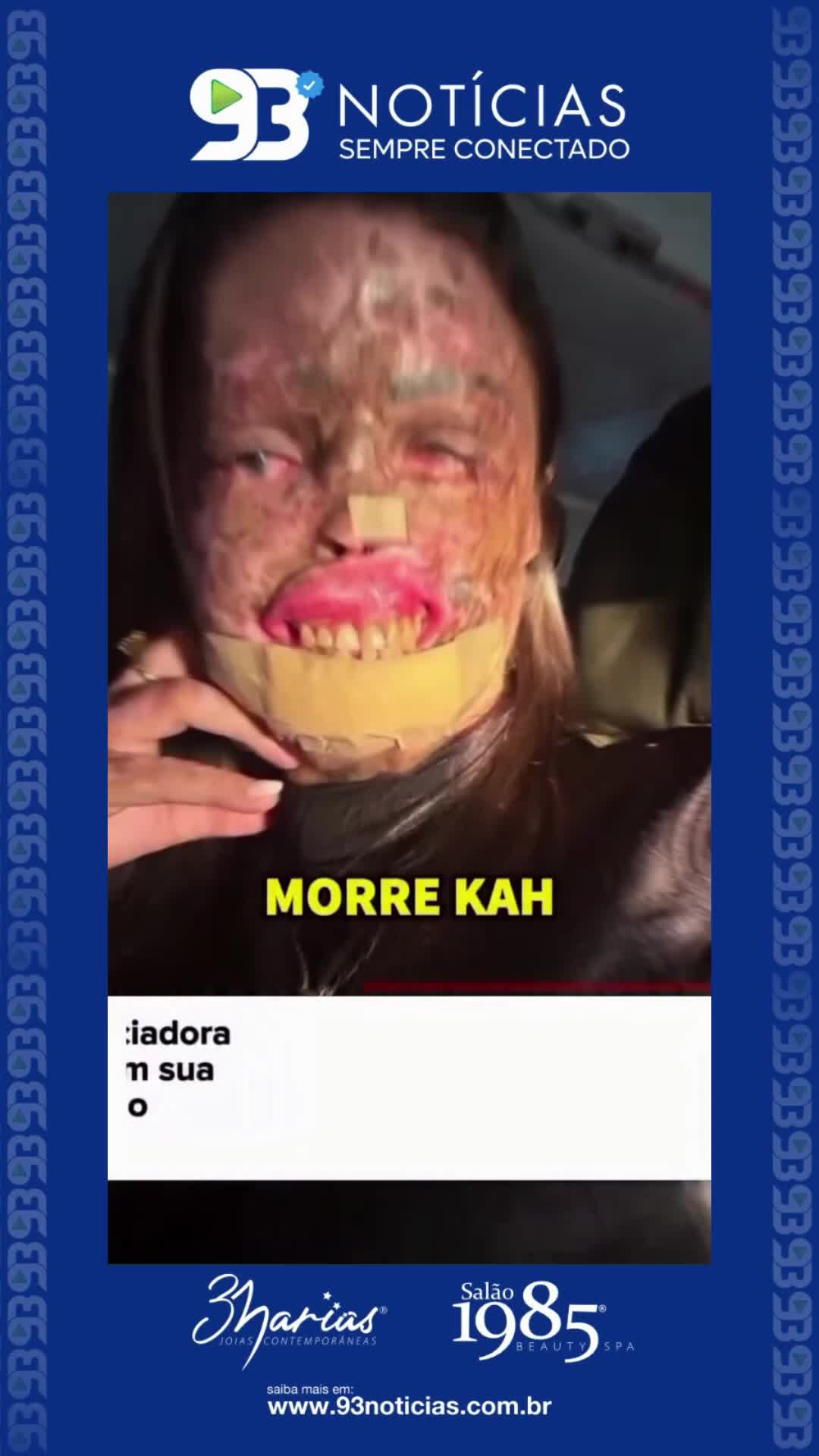 @93 Not&iacute;cias