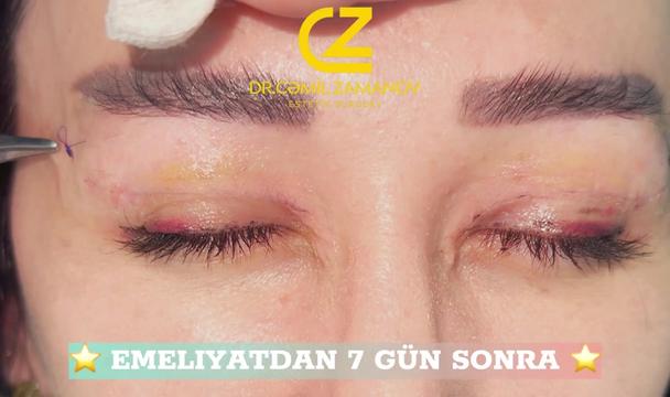 @Dr.Zamanov_Cemil