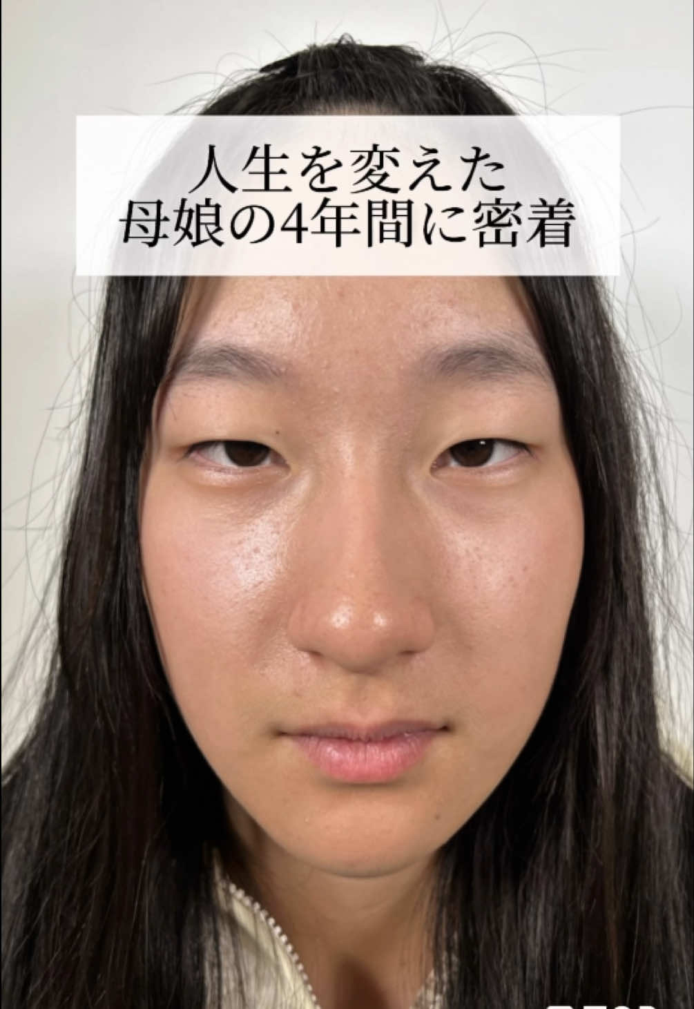 @【二重整形】TCB 新宿東口院ゆいこ先生/東京