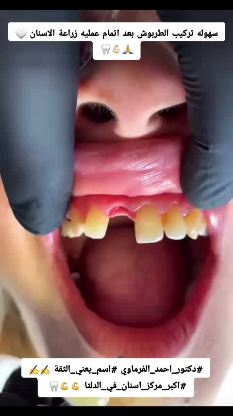 @دكتور احمد طلعت الفرماوي