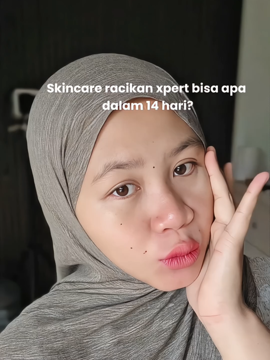 @Siskaandd