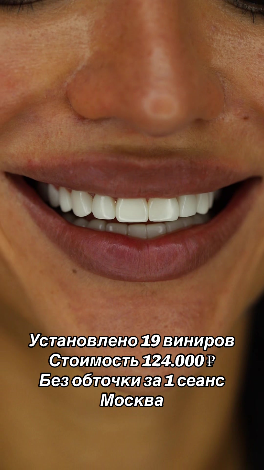 @Royal_smile_moscow