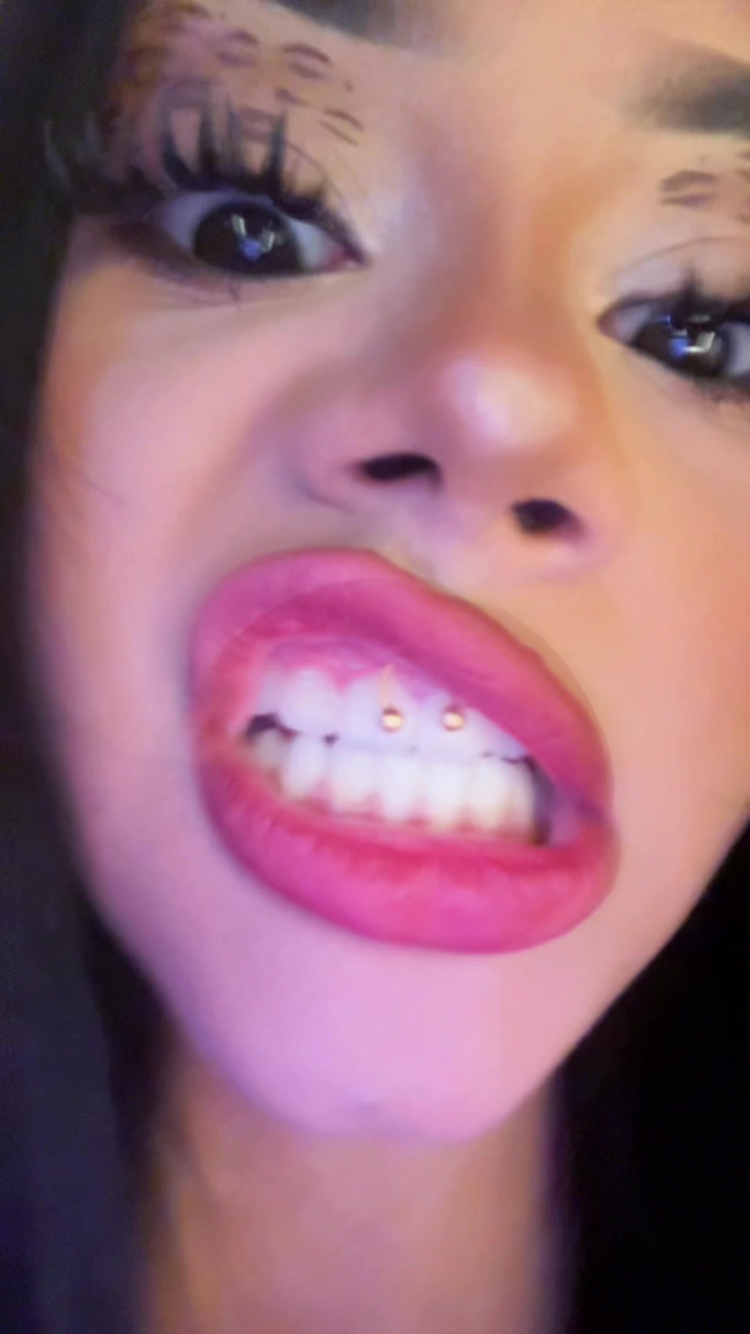 @kitty